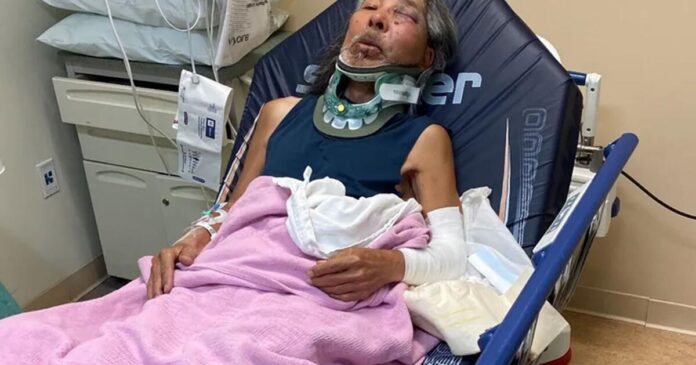Asian American professor who teaches history of racism attacked in possible hate crime